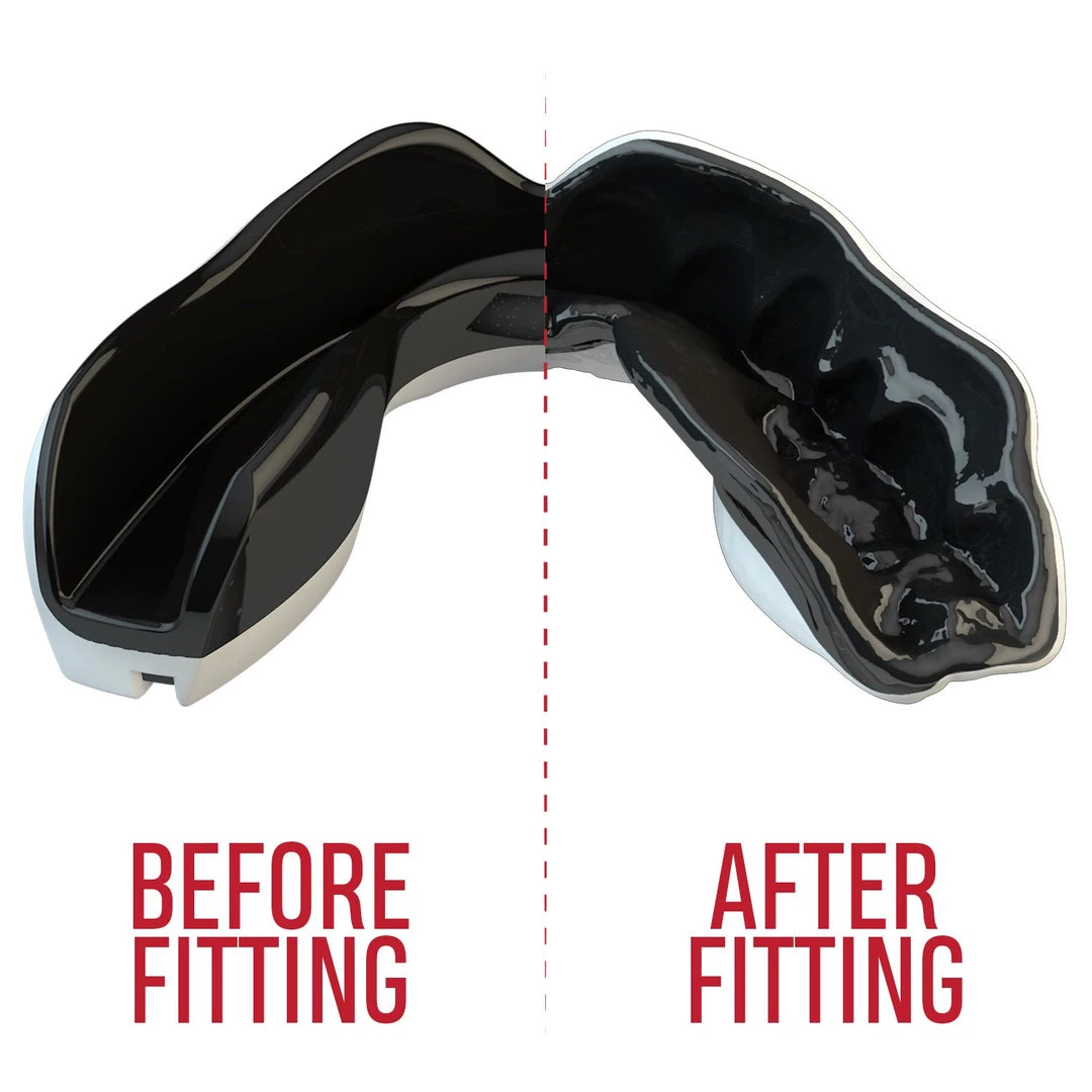 Safejawz Mouth Guard - Mo 5 Safejawz Mouth Guard - Mo